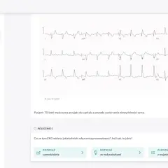 EKG pacjenta z niewydolnością serca. Interaktywny kurs EKG online pomaga analizować zapisy.