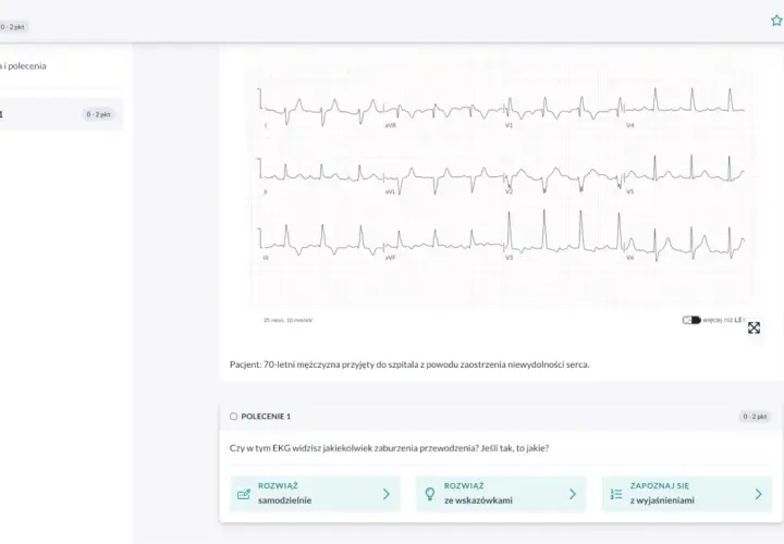 EKG pacjenta z niewydolnością serca. Interaktywny kurs EKG online pomaga analizować zapisy.