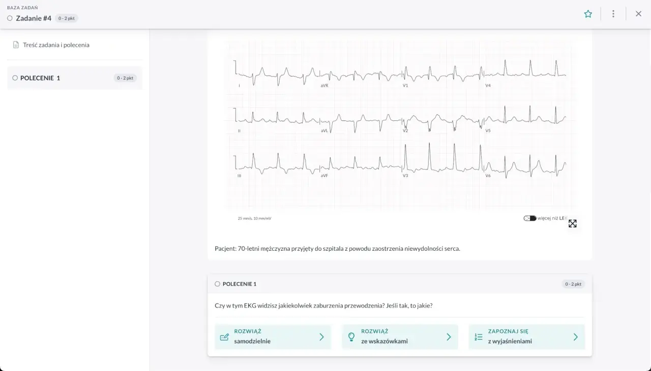 EKG pacjenta z niewydolnością serca. Interaktywny kurs EKG online pomaga analizować zapisy.